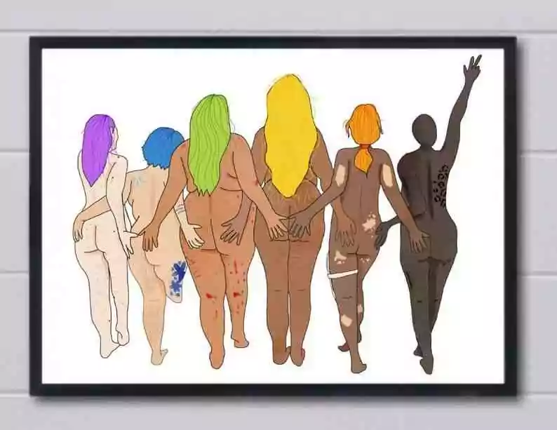 Diverse humans seen from the back, linking arms. Varying skin colors, vitiligo, amputee. Body positivity art.
