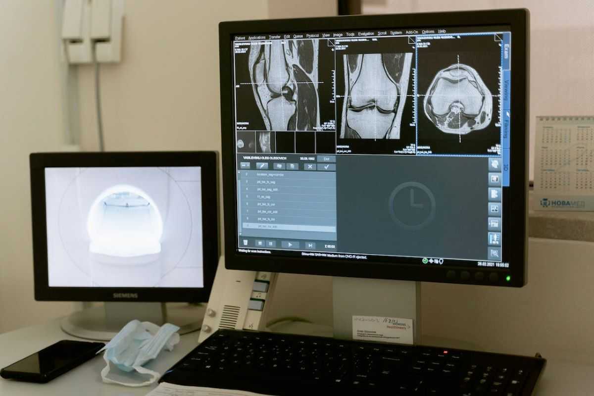 X-ray to test for osteoporosis